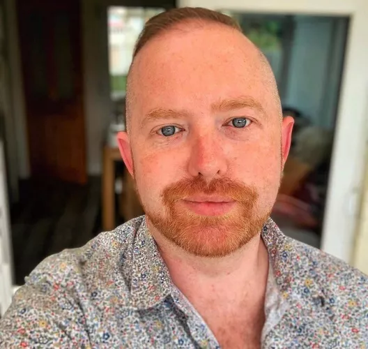 My Freckles use to be my insecurity. Now I just have to admit and own. I think it makes me cute