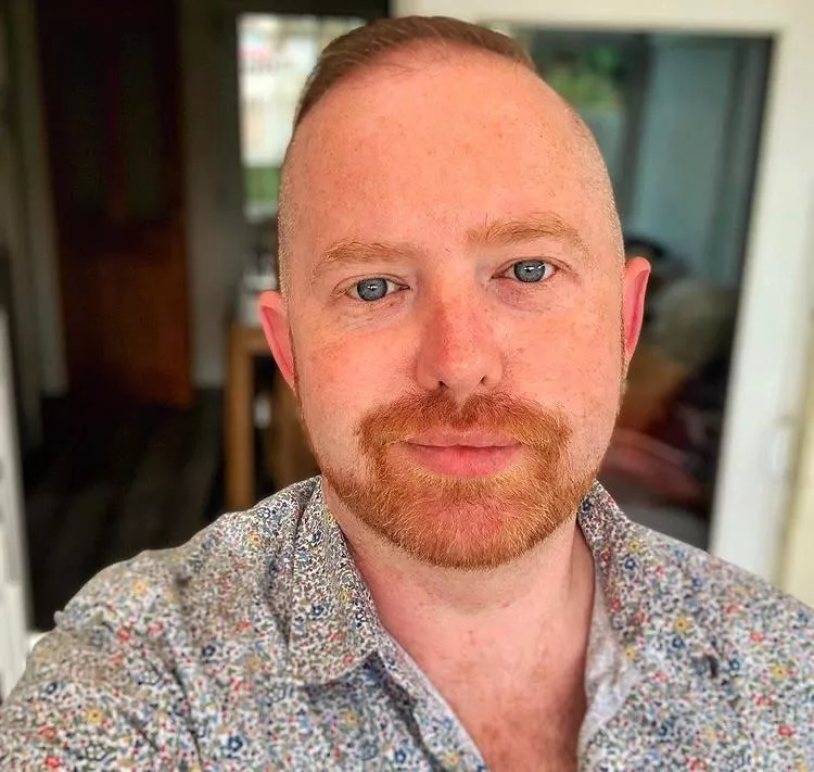 My Freckles use to be my insecurity. Now I just have to admit and own. I think it makes me cute