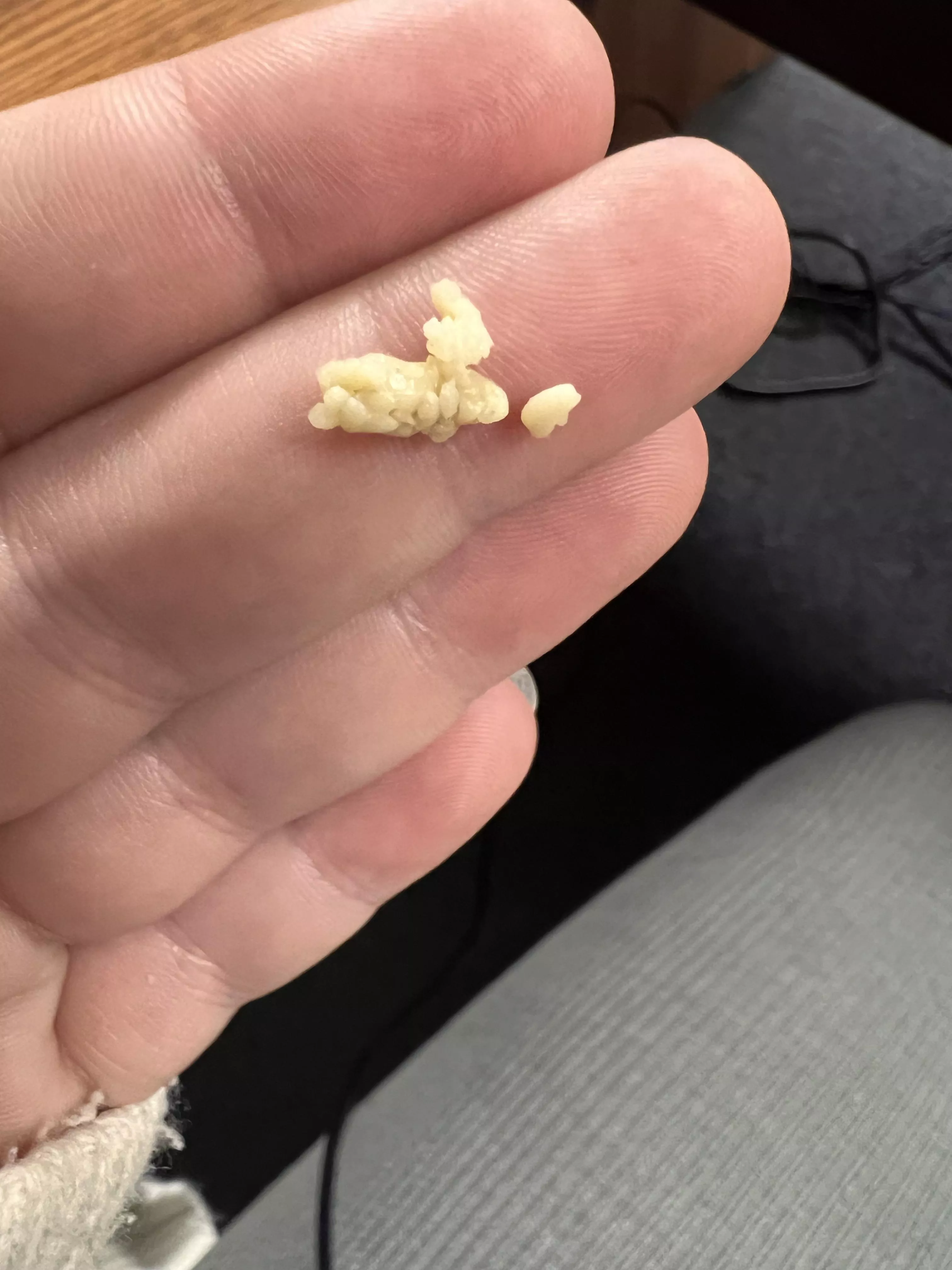 Coughed and this thing shot out! Have more in there but idk how to get them out without gagging