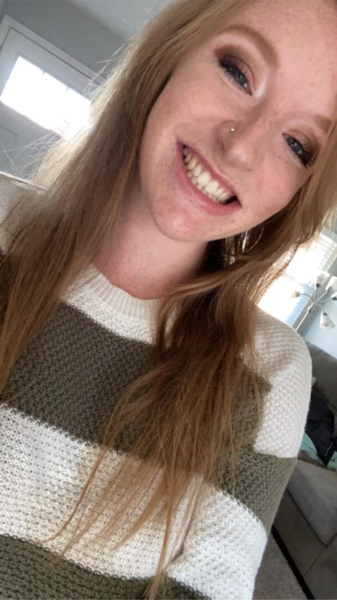 Do you really like freckles