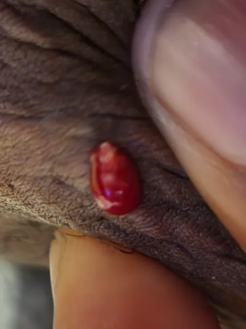 Bump on inner thigh (hurt like hell)