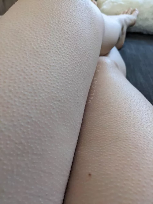 sometimes I get goosebumps when I sneeze
