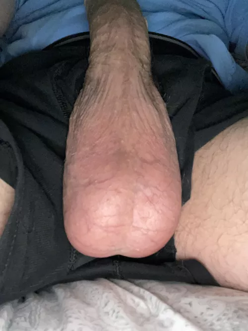 In desperate need of draining….