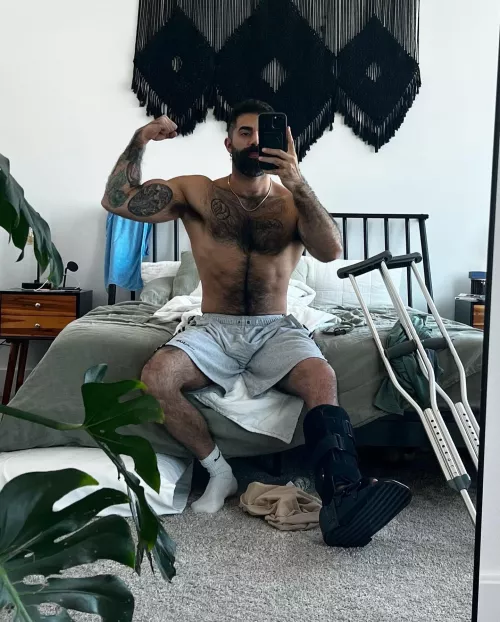 Alpha pits, broken leg or not