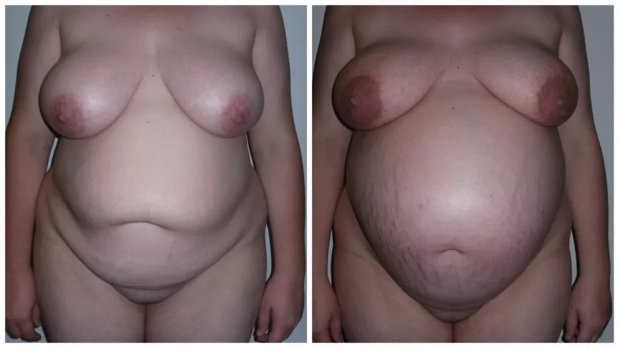 3 months or so vs ready to pop!