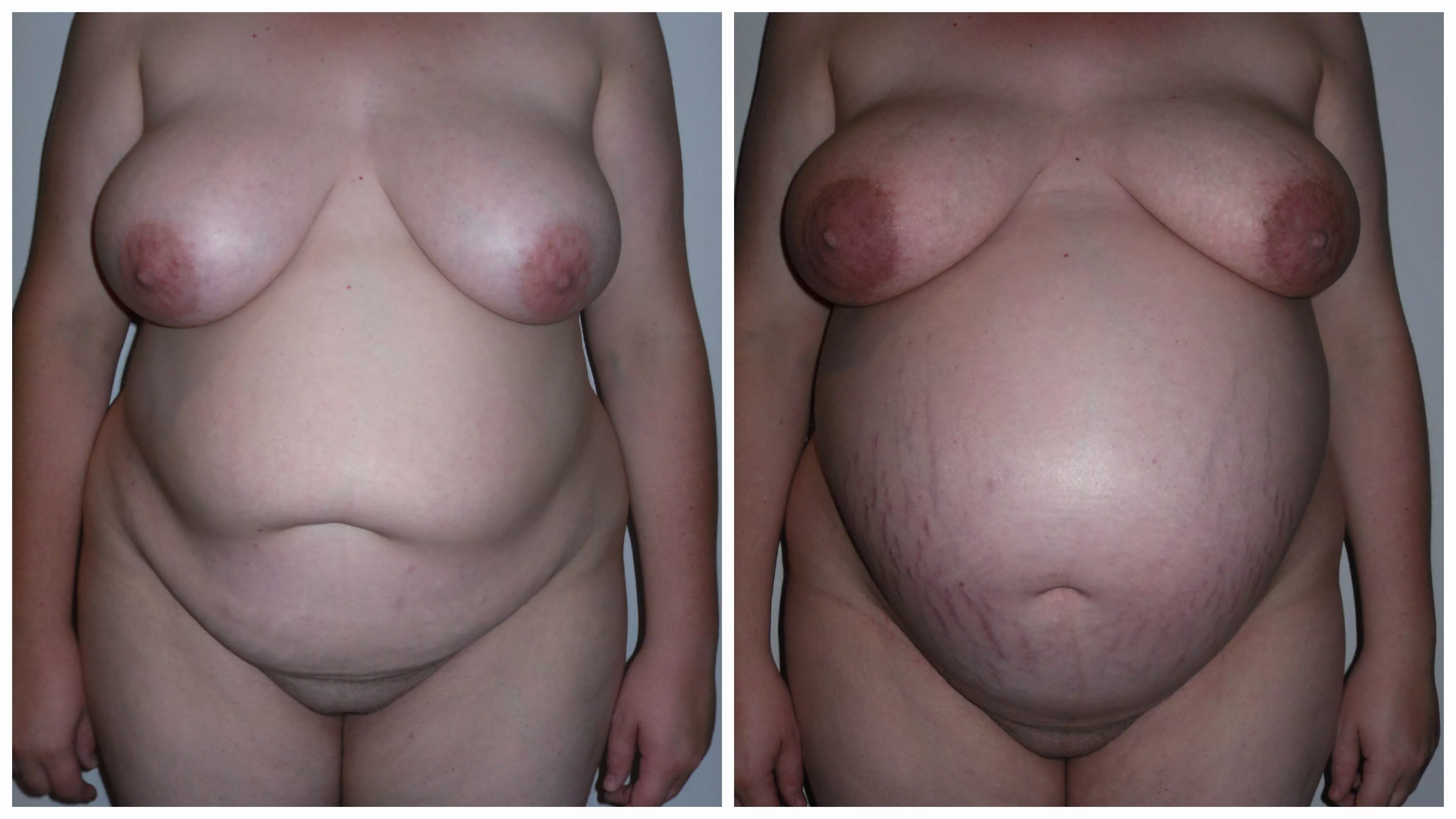 3 months or so vs ready to pop!