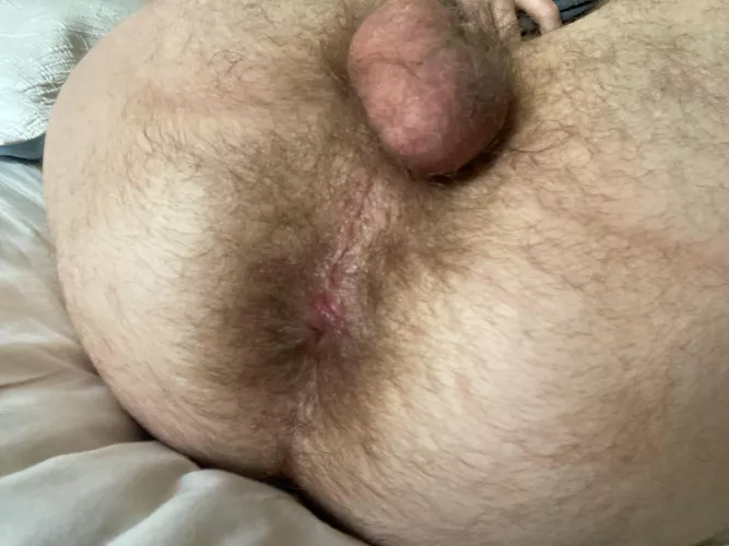 [32] Hairy or Fuzzy?