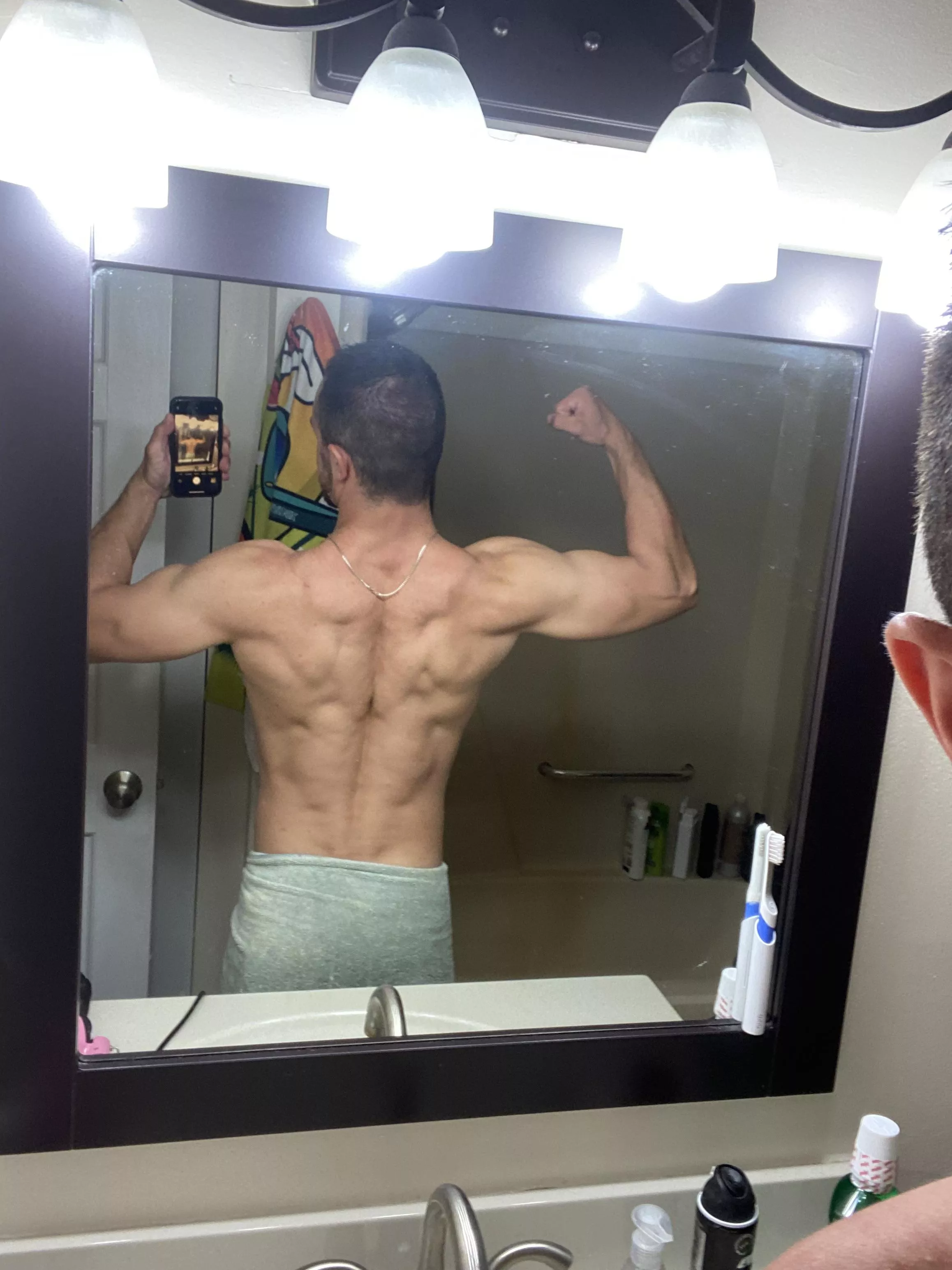 Back with a side of forearm?