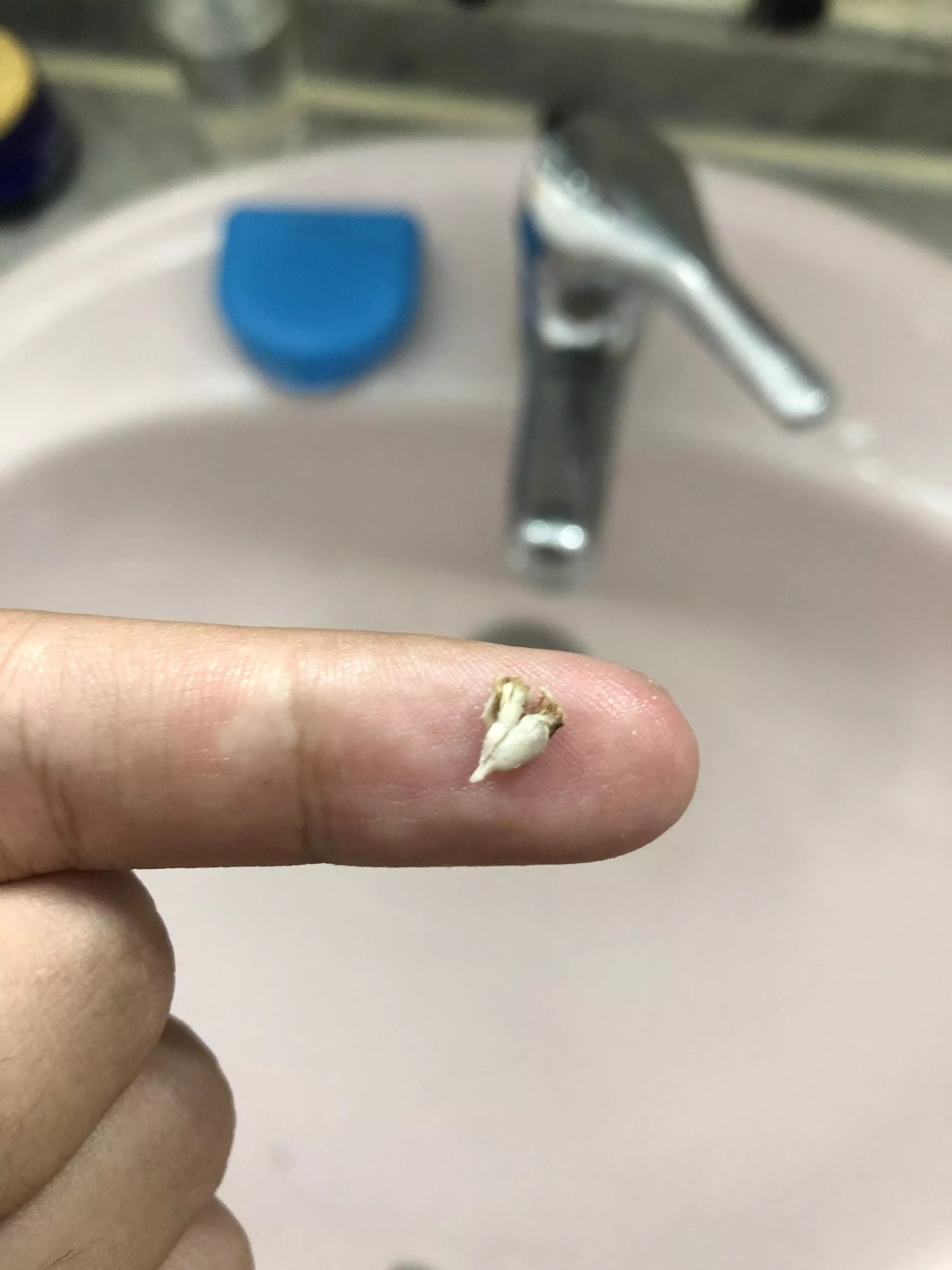 Finally got this sucker out of my bellybutton
