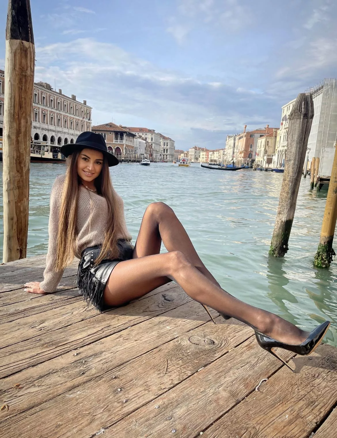 My legs are my privilege