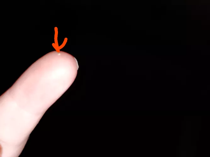 Really gross keratin plug I popped out of my forehead