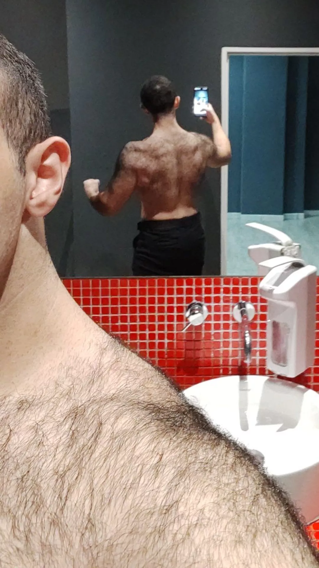 +1 if u like fur on back