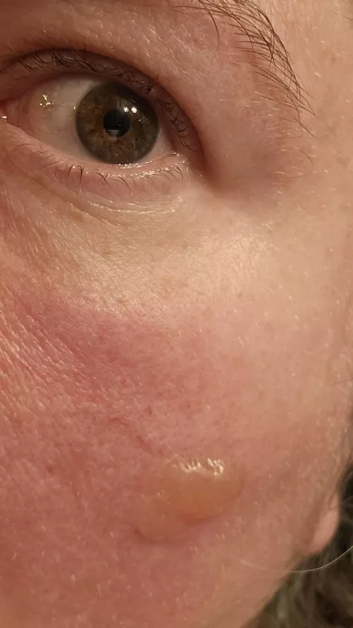 Forbidden face bubble