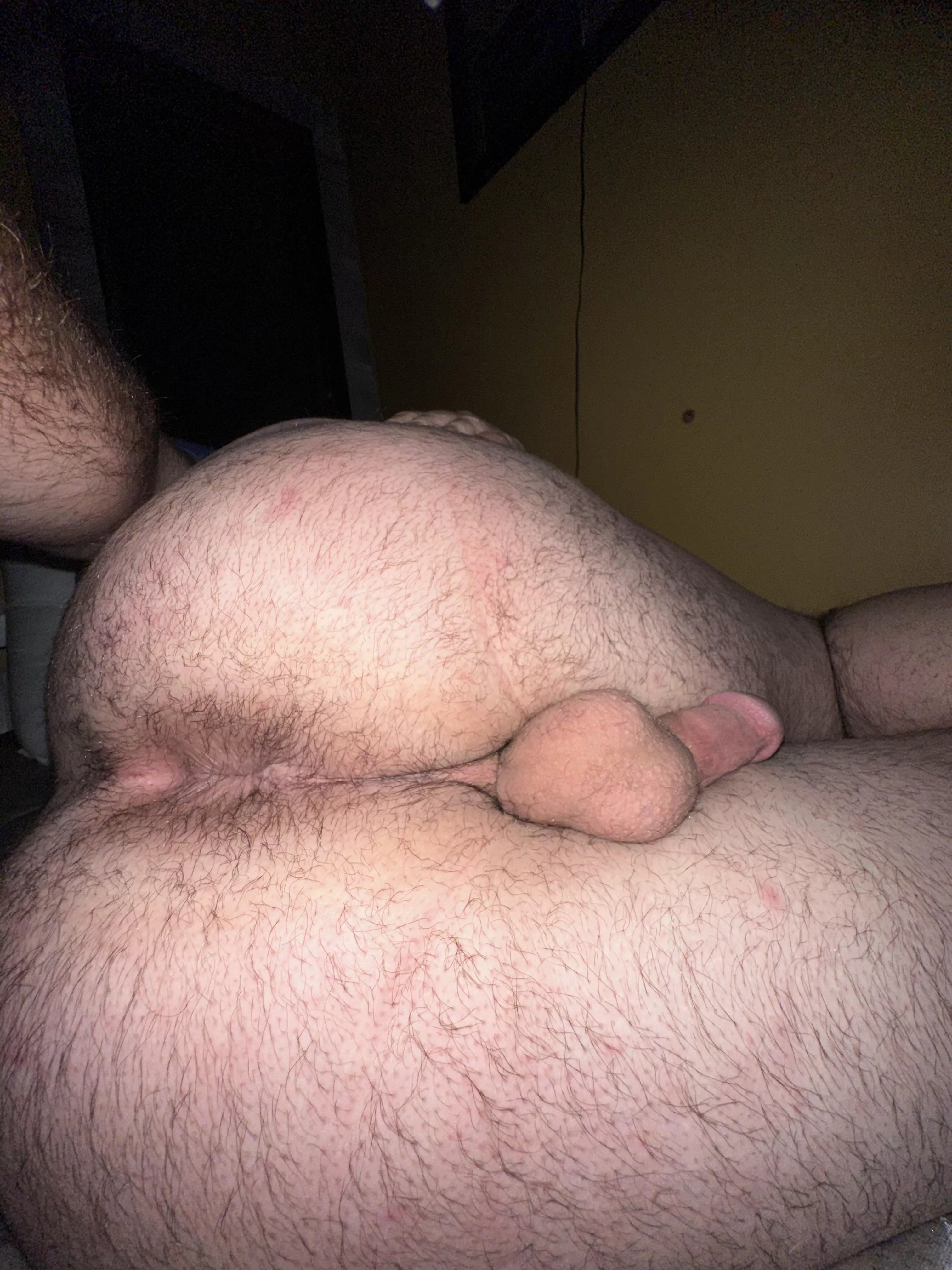 Should I let it grow out more or should I shave? (22)