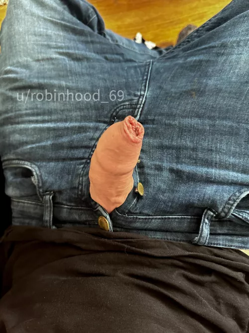 Your favorite foreskin