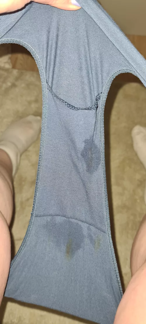 I think this brown spots are really cute!