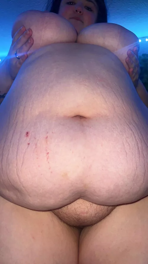 the stretch marks just keep going up 😩