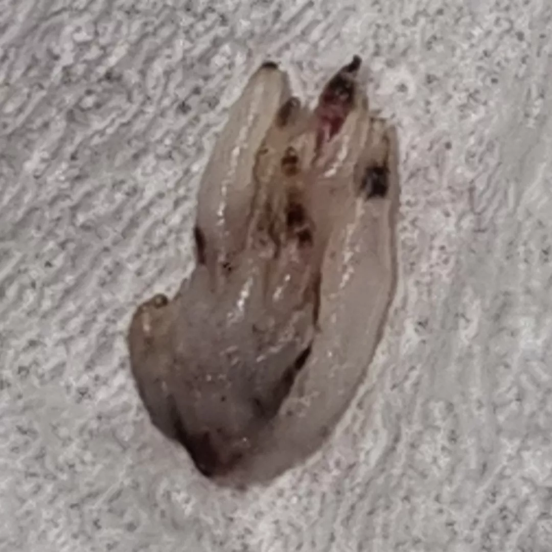 Removed a family of ingrown hairs from my dog