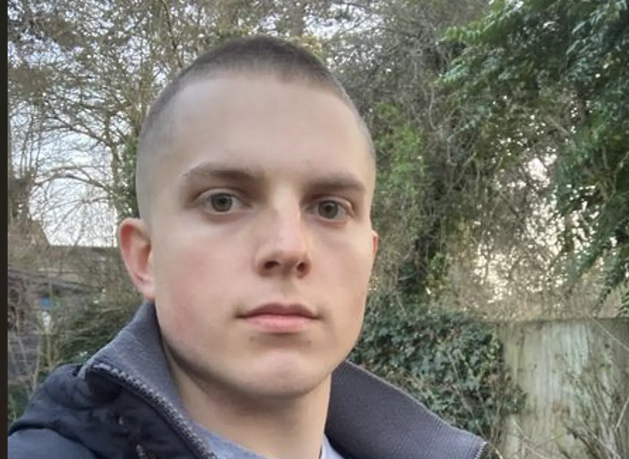 Hi guys! Really appreciate your perspective on that previous post! I once had my lips pierced like an idiot, but then had them removed, which has forever meant I am left with these ugly 'white' marks. I think they look weird AF. What that would be your