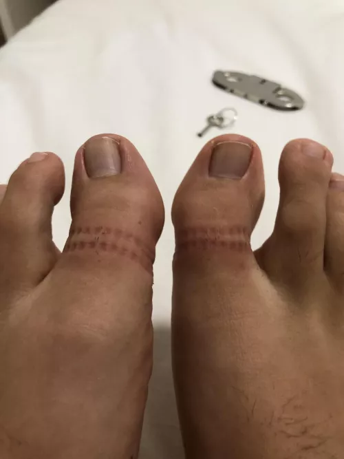 Finally I was allowed to unlock the thumbcuffs