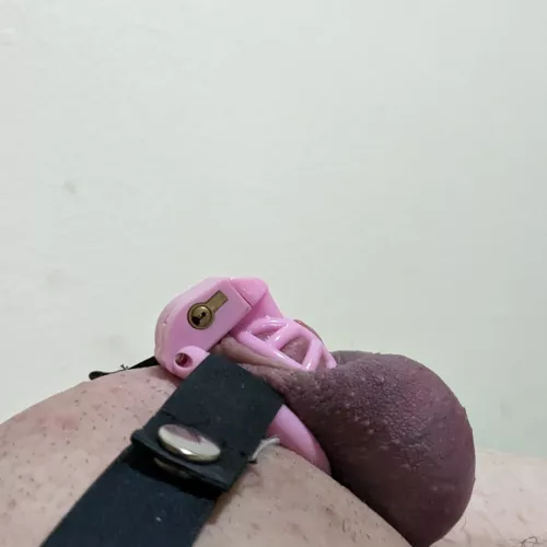 is this amount of discoloration bad? there wasn't any pain, but it felt very tight and there was a dull ache. this is is the only ring I have that stops the cage from sliding up the shaft.