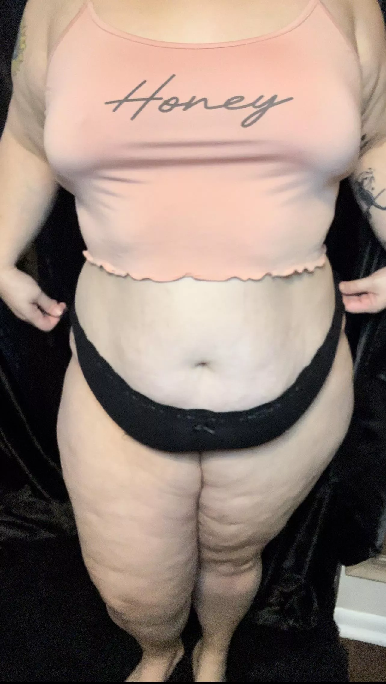 Do men like women with stretch marks & cellulite?