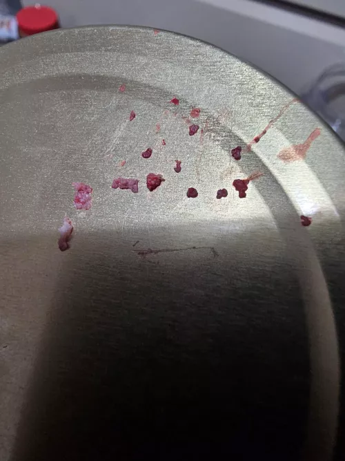 Aftermath of a pimple