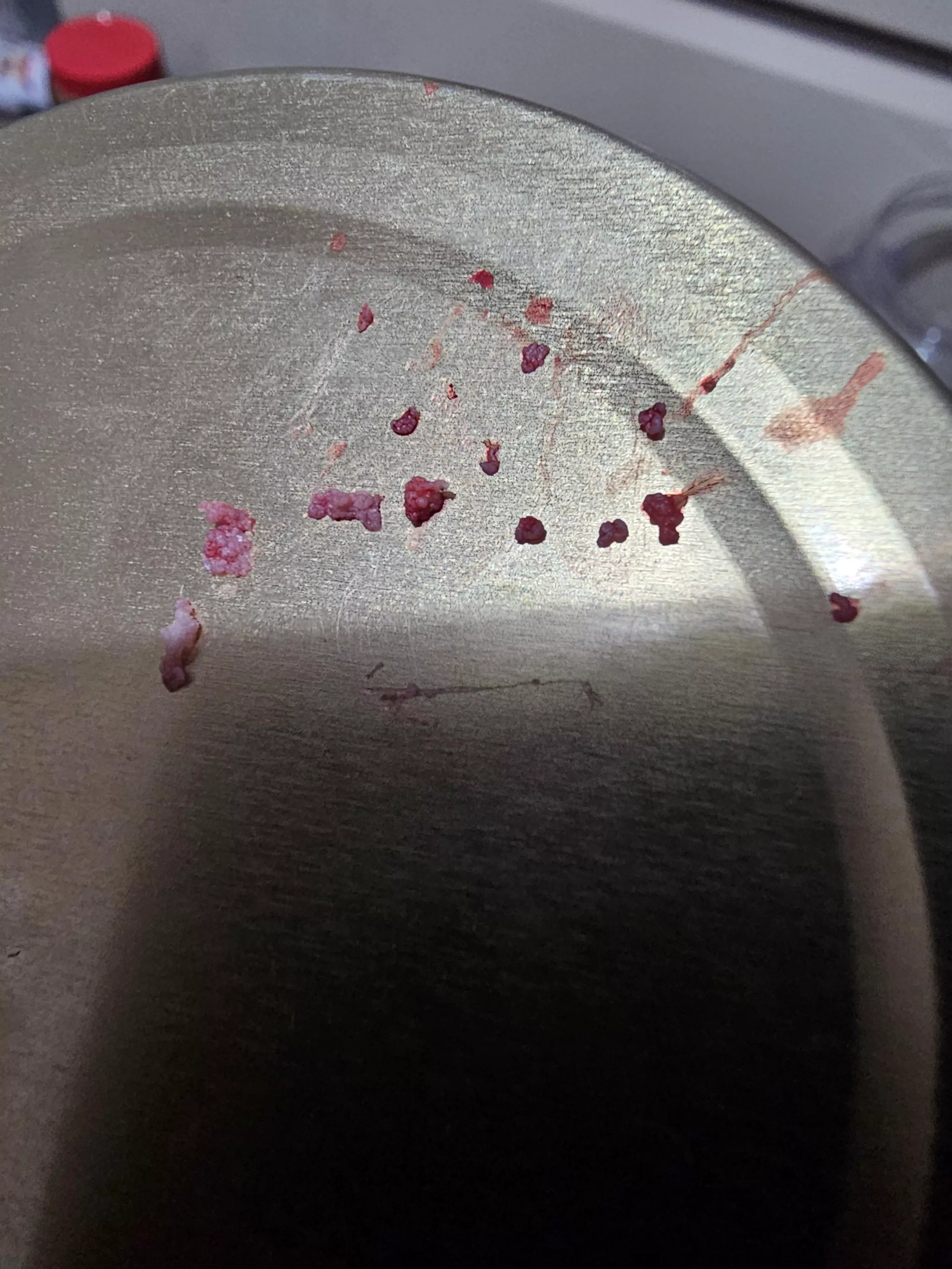 Aftermath of a pimple