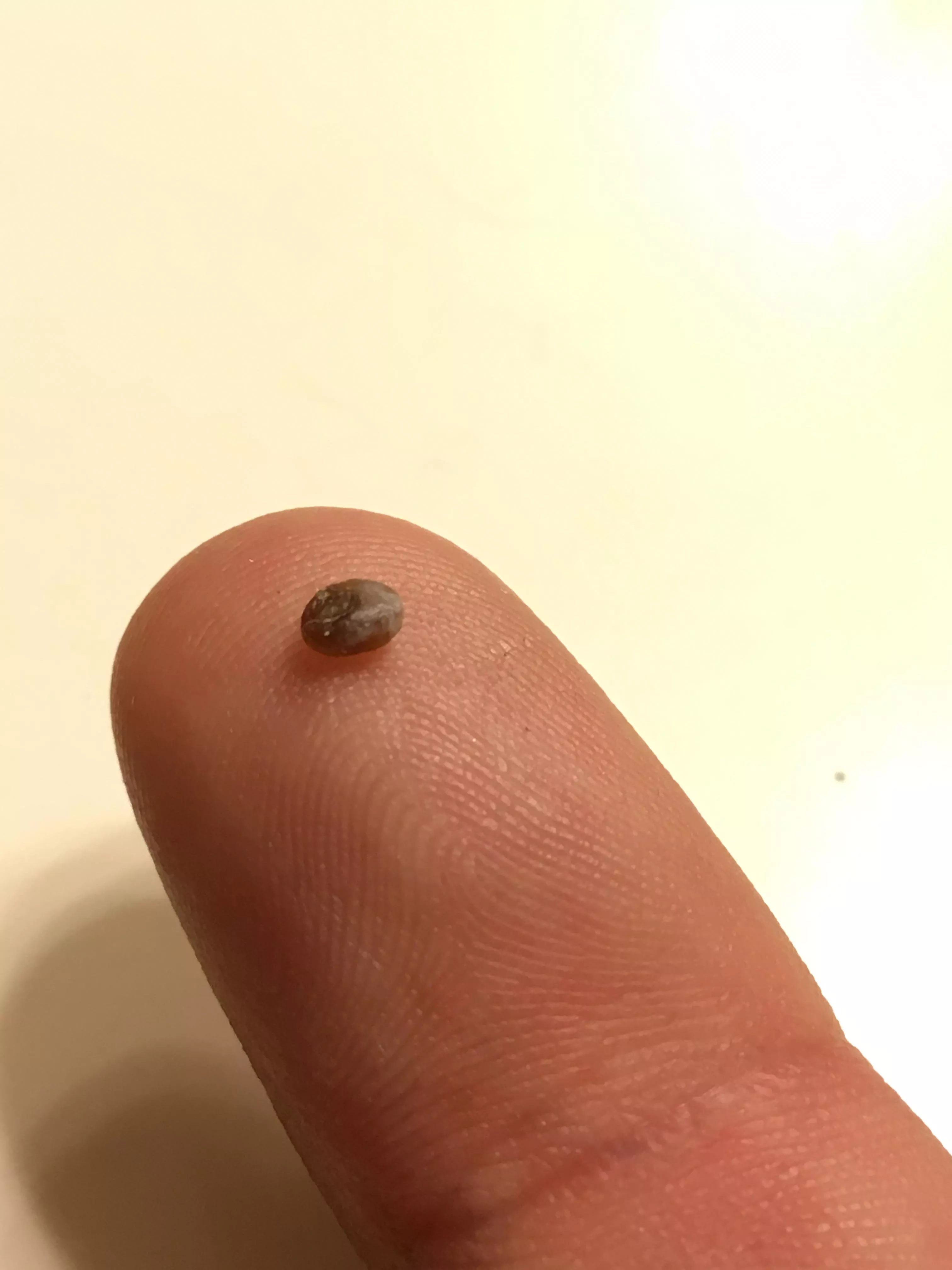 What came out of my skin?