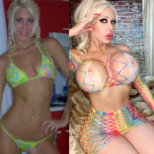 Should i get a cat eye surgery or get my lips bigger?