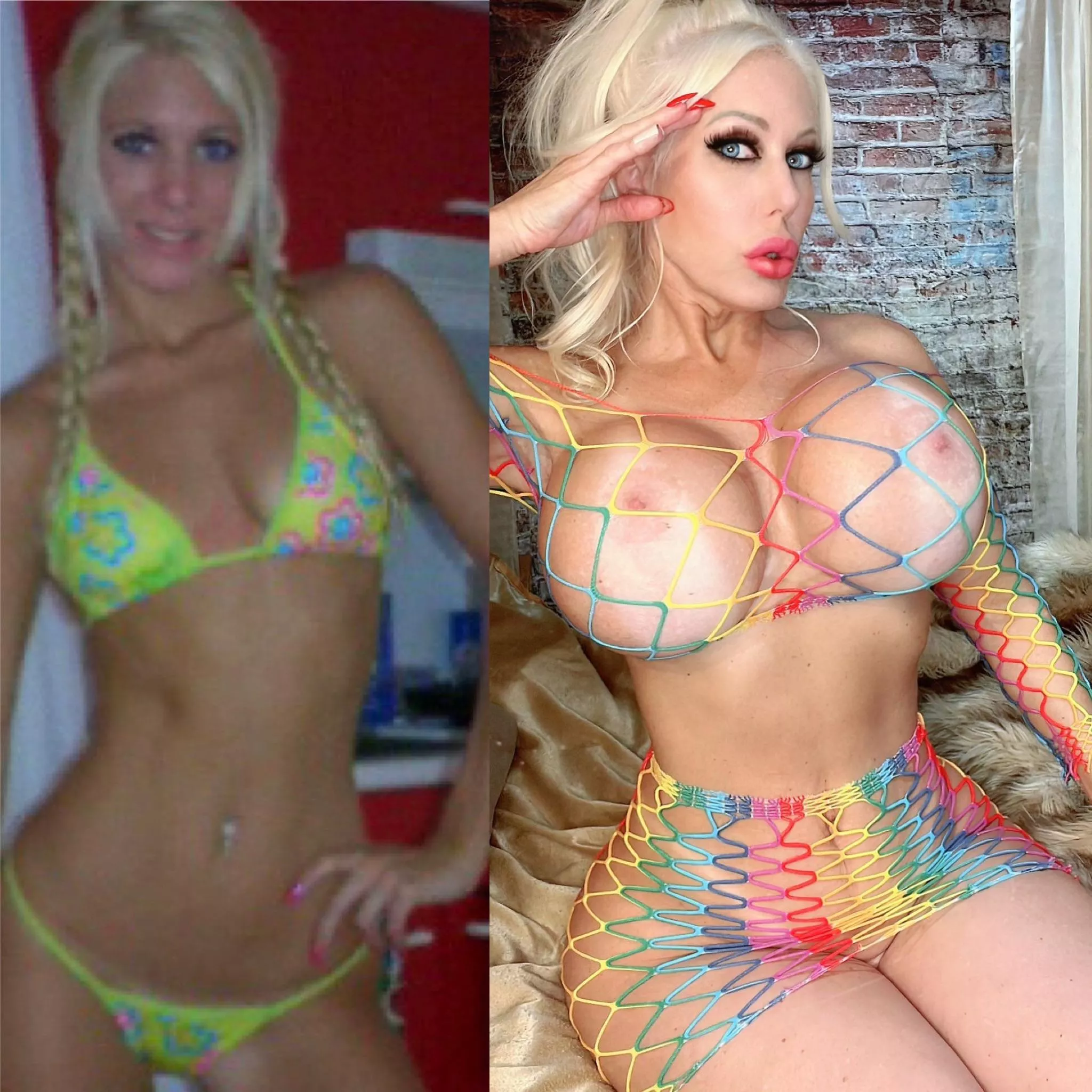 Should i get a cat eye surgery or get my lips bigger?