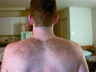 Who wants to rub my hairy back?