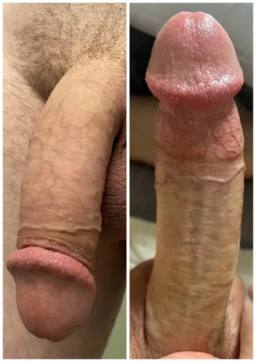 Flaccid or full?