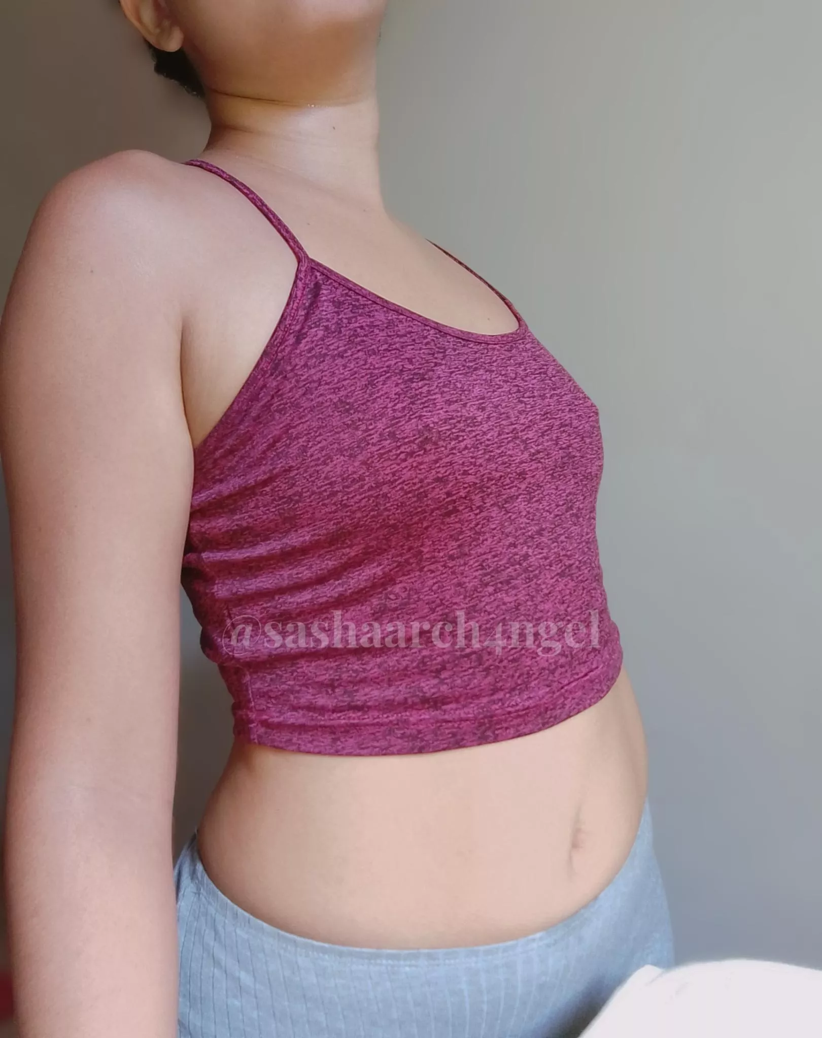 My mosquito bites are kinda cute