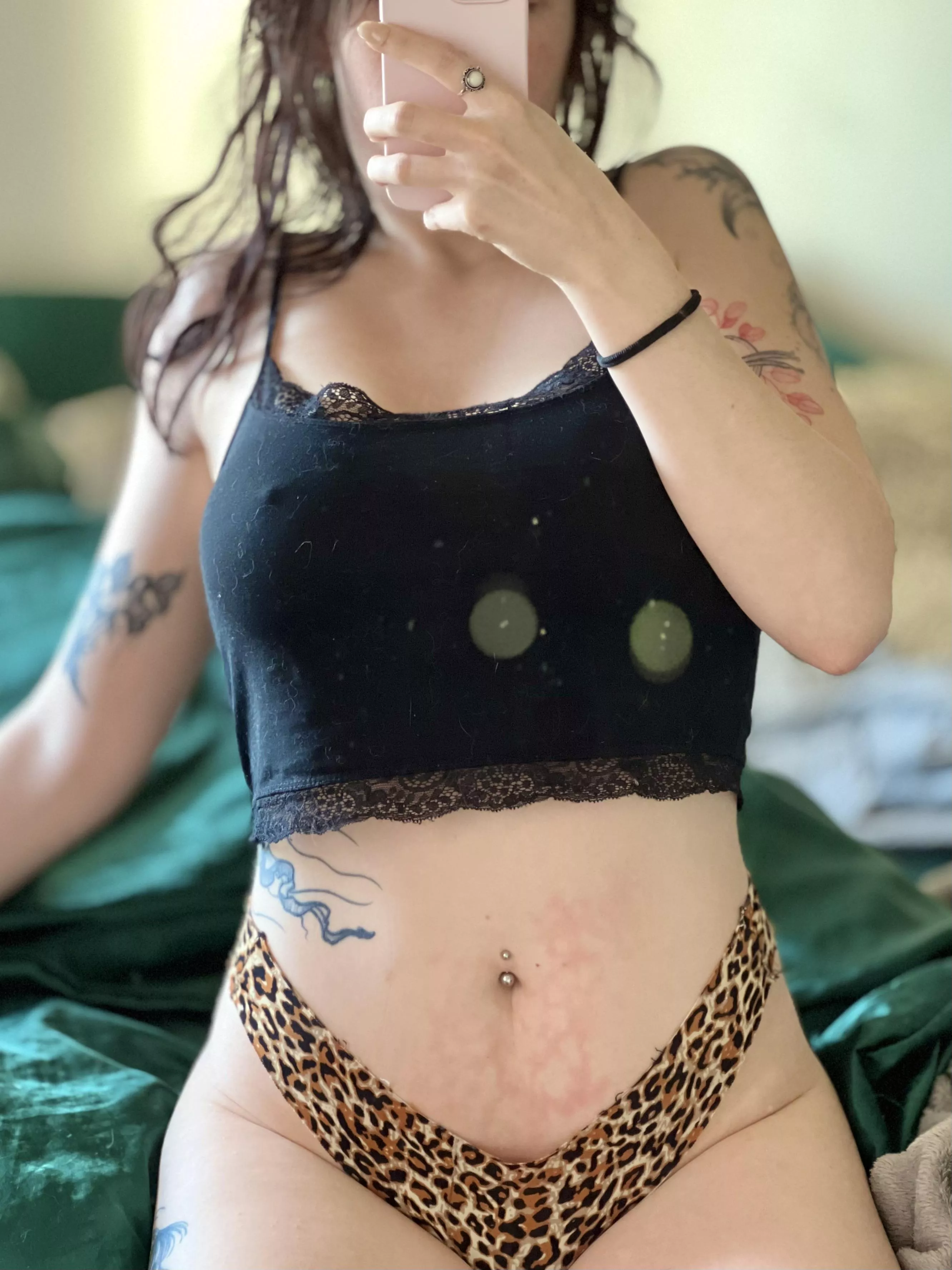 Woke up with an interesting water bottle burn mark [f]