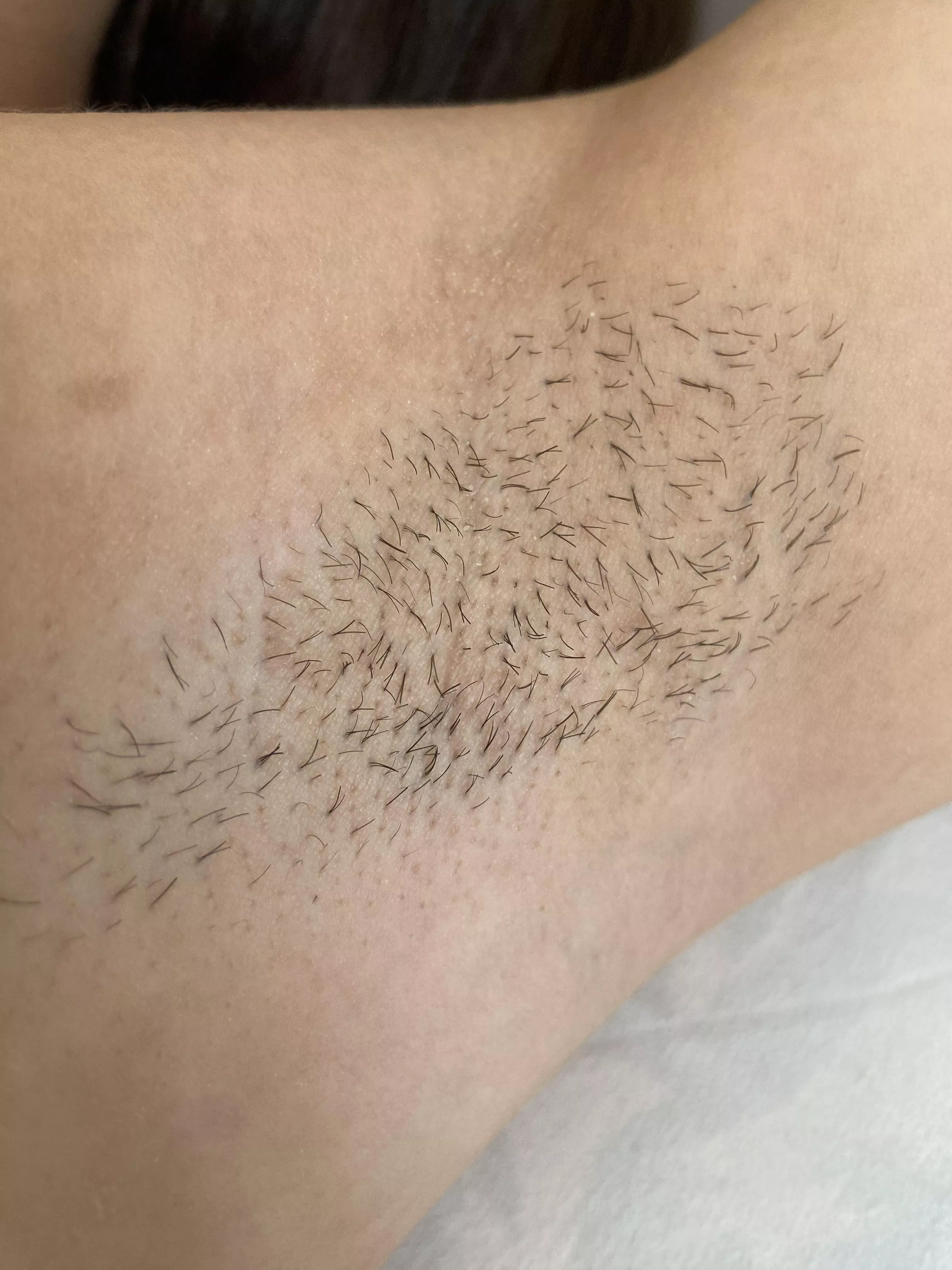 My closeup stubble pit