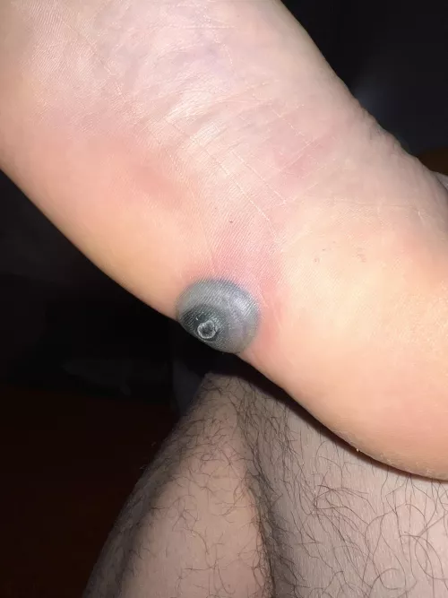 Really wish I can f**king pop this