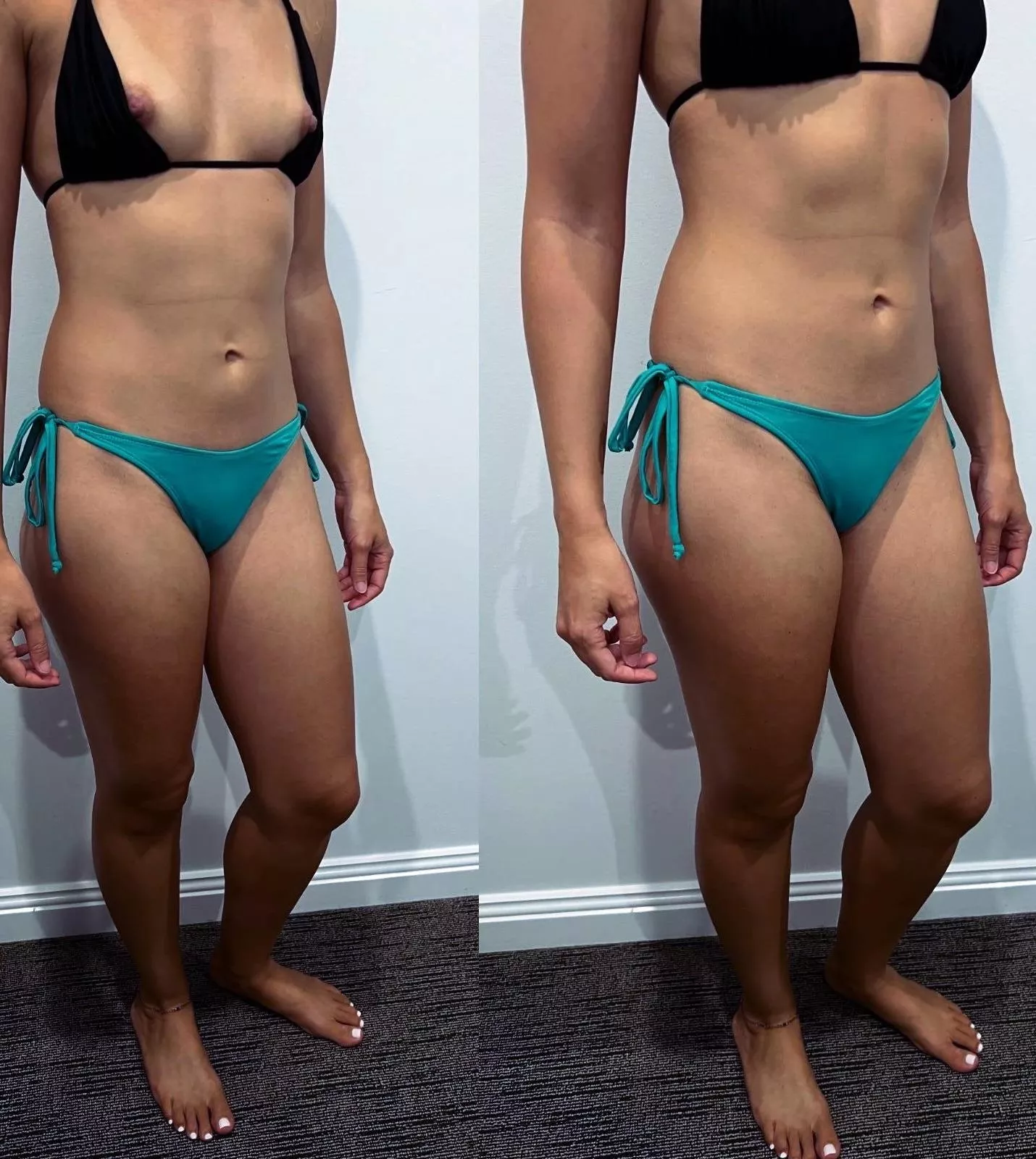 These keep falling out i am not sure i can go to the beach