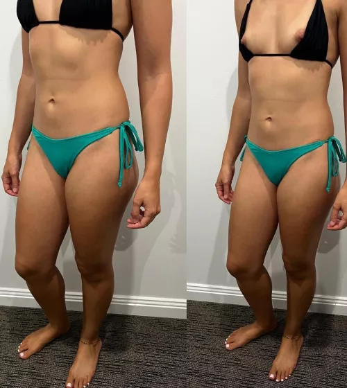 I like when they fall off so you can use your tongue instead of sunscree