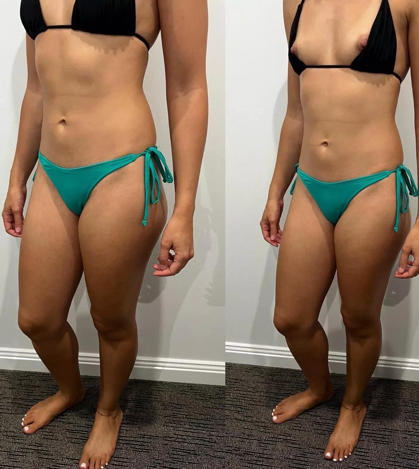 I like when they fall off so you can use your tongue instead of sunscree