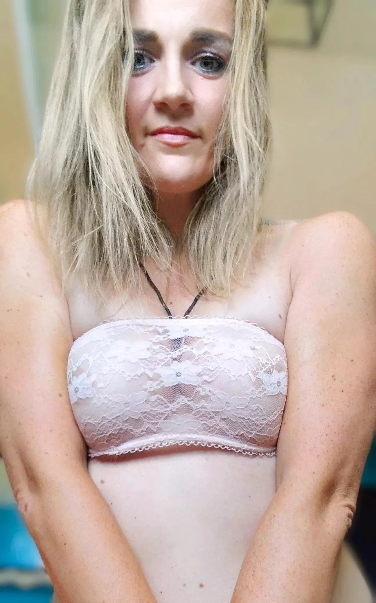 F41 peach skin and freckles