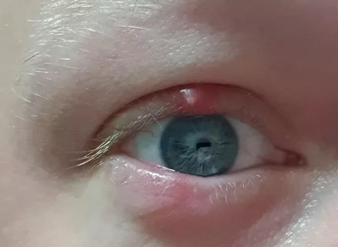 Another forbidden pop