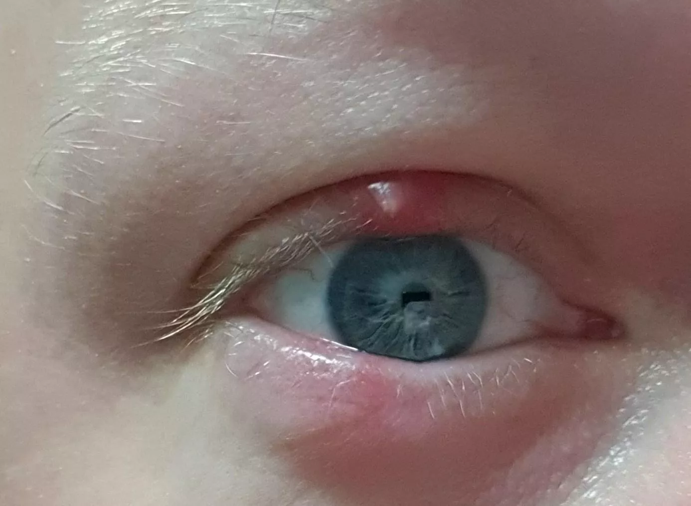 Another forbidden pop