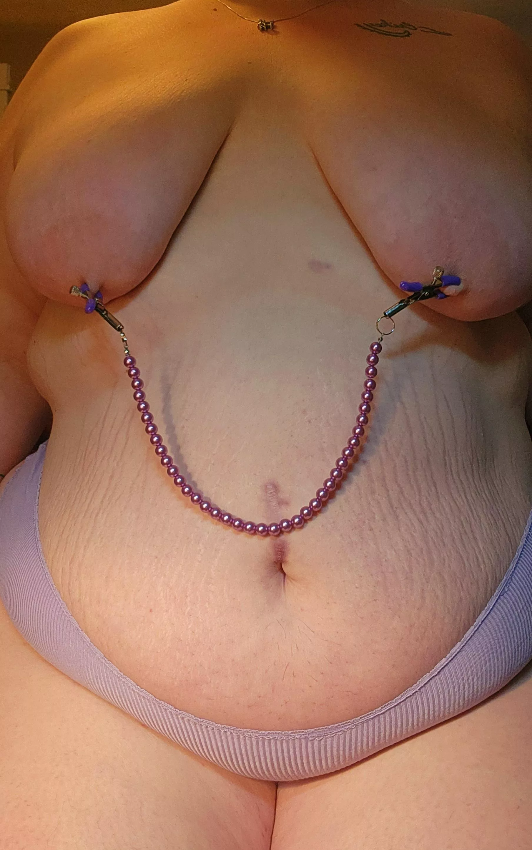 I think my stretch marks are cute.