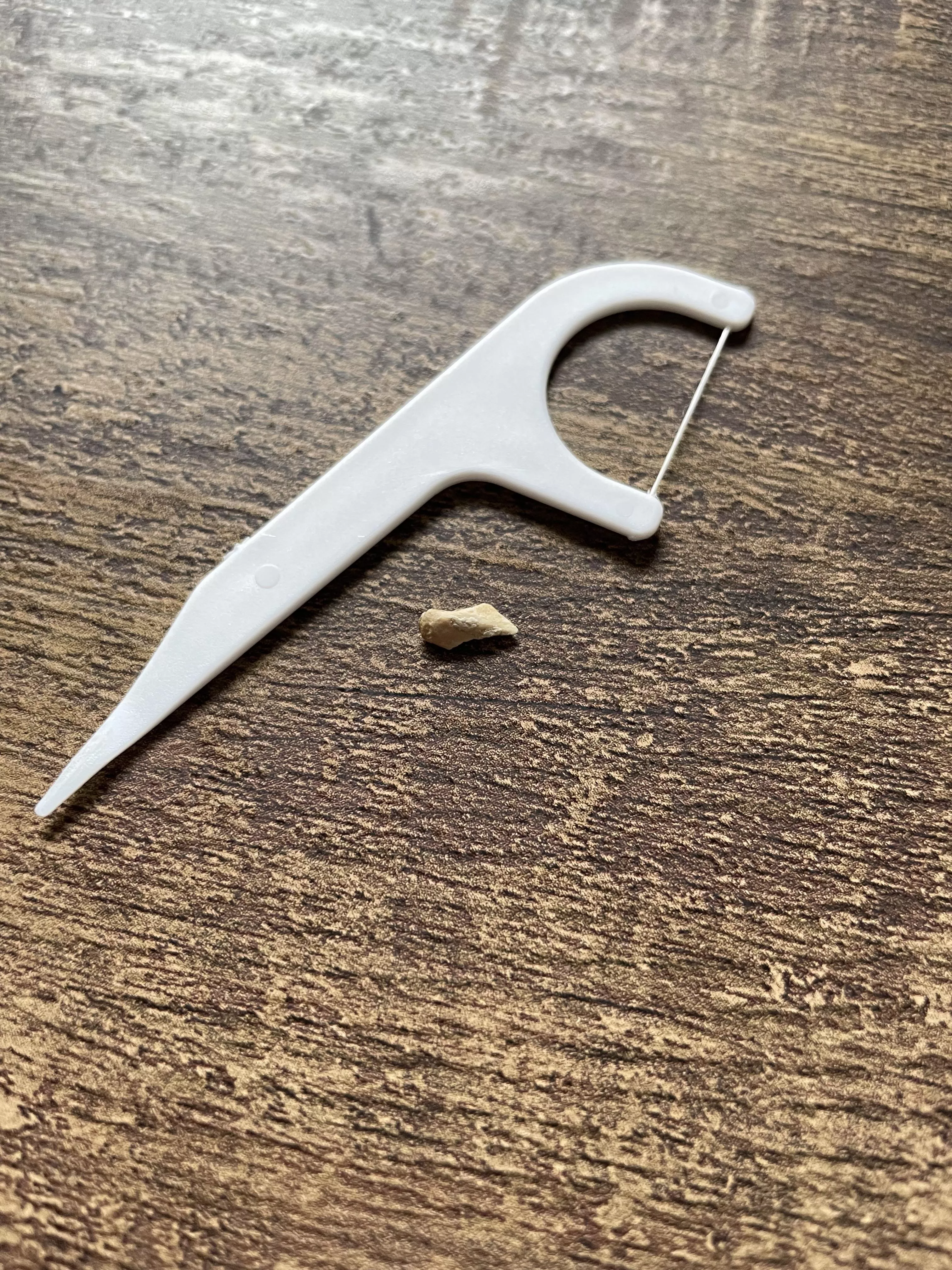 Removed this calcium buildup from behind a bottom, front tooth.