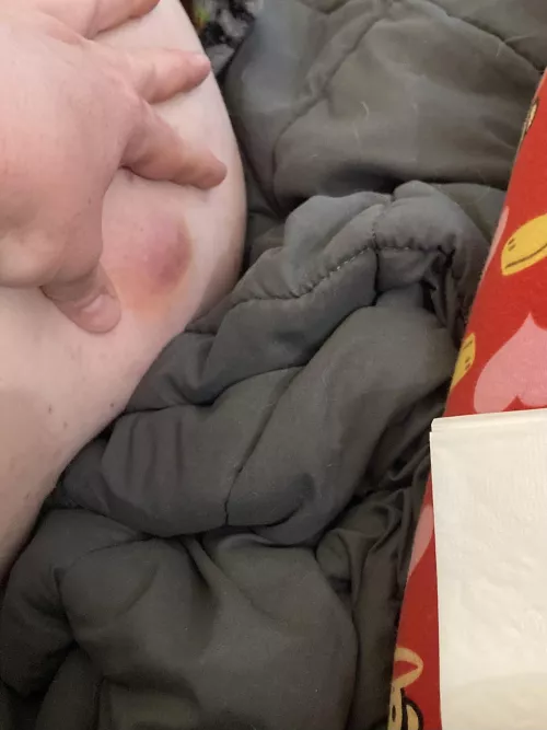 A bump on my hubs behind OC