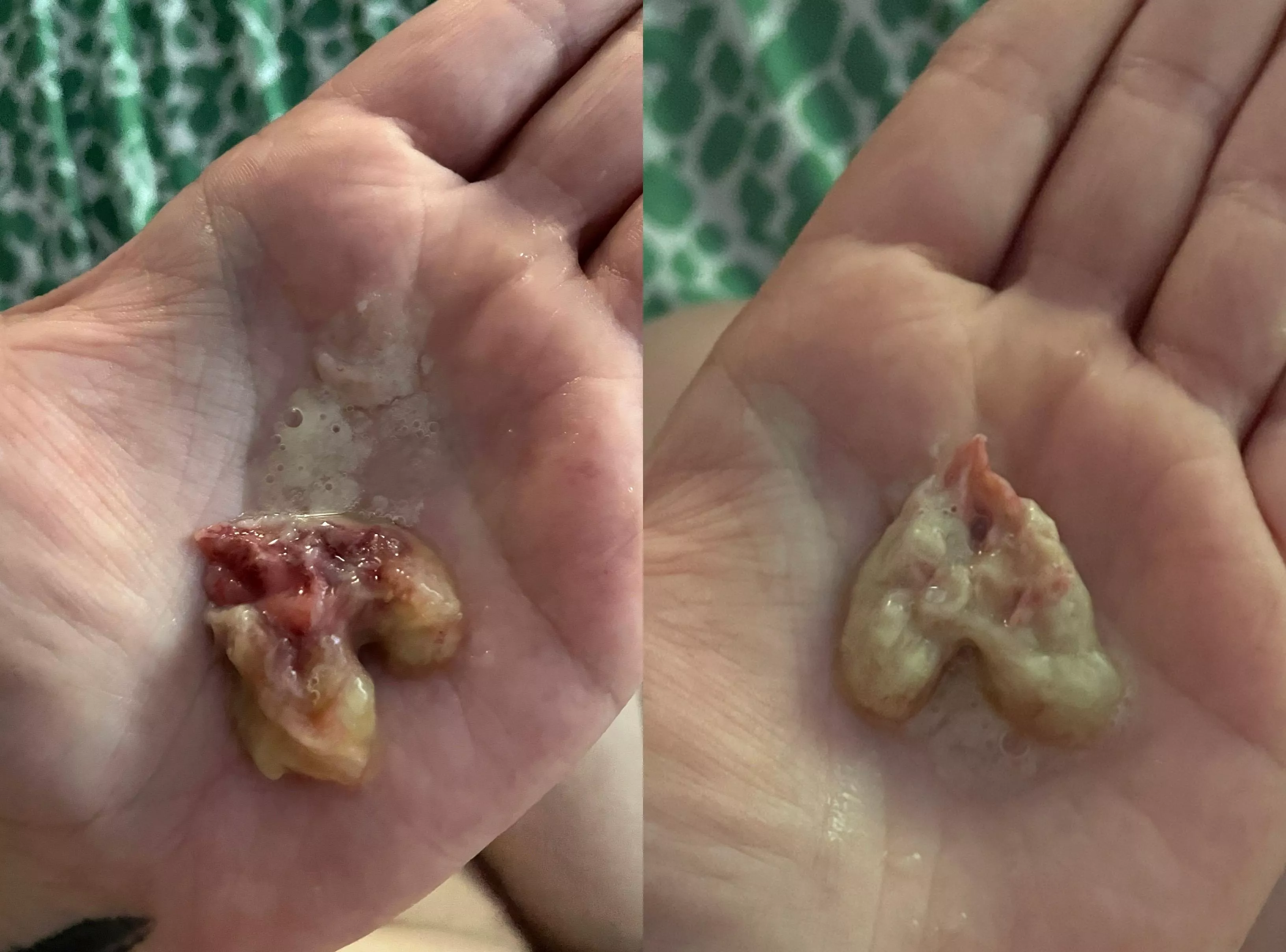 Birthed (coughed) out this mucus ball after being sick for 5 weeks and now I can BREATHE!