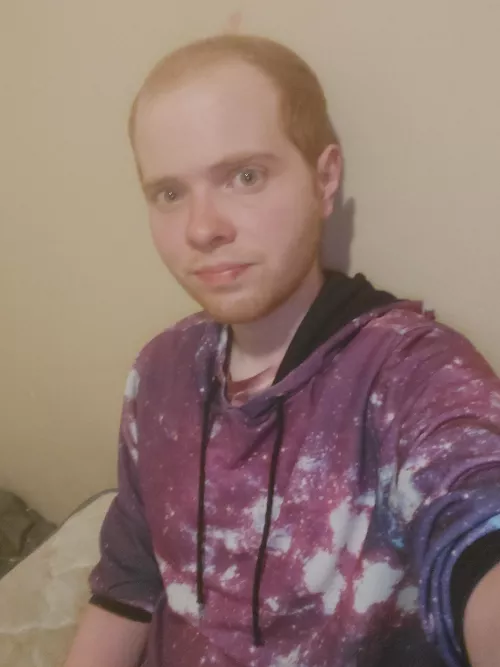 I'm starting to lose my hair and have been really self conscious lately. Hopefully this photo isn't too bad.