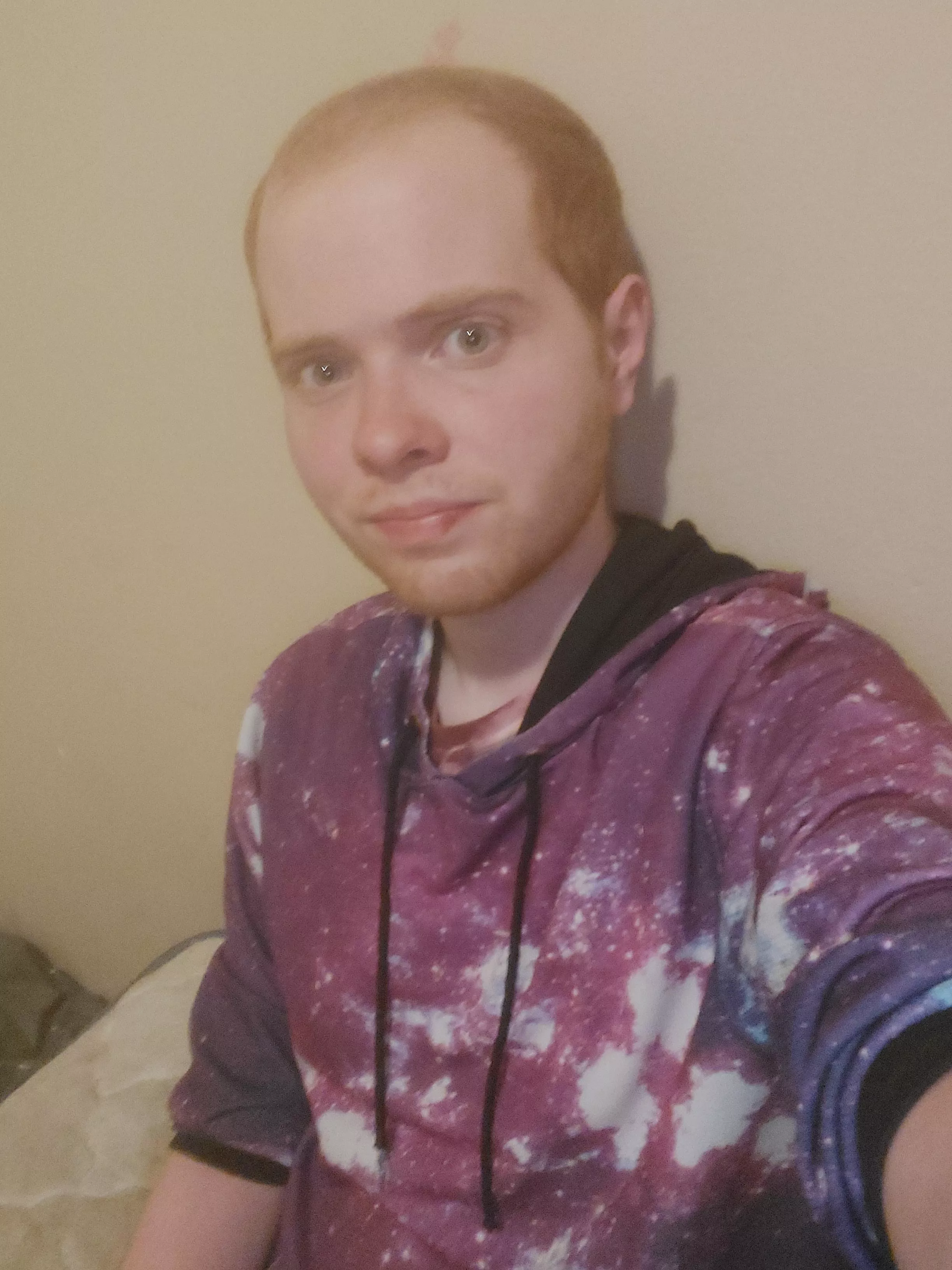 I'm starting to lose my hair and have been really self conscious lately. Hopefully this photo isn't too bad.