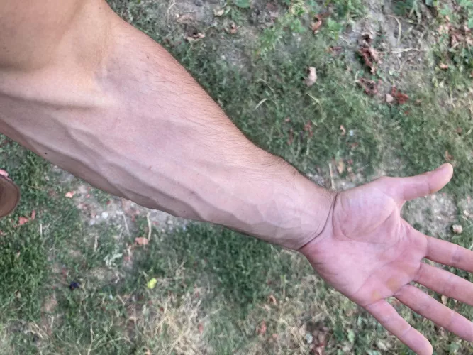 Someone said my hands are rejecting due to my calluses , are they right ?